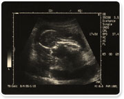 וולפסון: בדיקות הריון לאם ולעובר החל משבוע 39 להריון