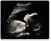 אולטרה-סאונד: כל הבדיקות בהריון